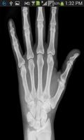 XRay Scanner Prank captura de pantalla 2