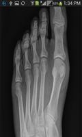 XRay Scanner Prank captura de pantalla 3