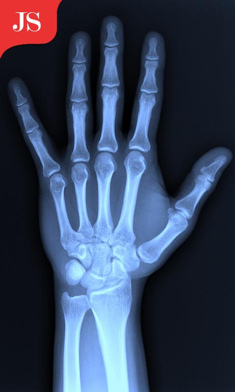 X ray games. Рука ребенка 8 лет рентген. Сканер кисти. X-ray body Scanner. Телефон XRAY.