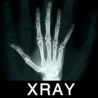 X-Ray Scanner PrankApp Affiche