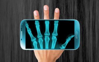 X-Ray Scanner PrankApp تصوير الشاشة 2