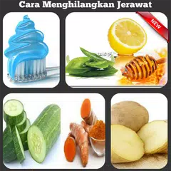 Cara Menghilangkan Jerawat