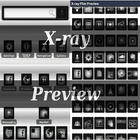 Free X-ray Film preview أيقونة
