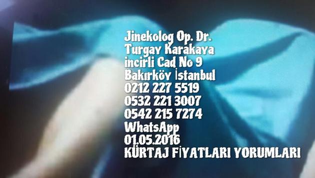 Jinekolog Op Dr Turgay Karakaya Uzmanlik Belgesi Vakum Kurtaj Istanbul