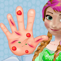 Hand surgery
