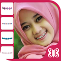 Behel Camera Cantik