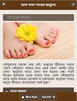 ভাগ্য যখন পায়ের আঙুলে! 포스터