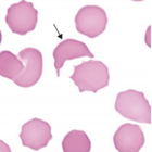 Hematology quiz App icon