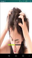 علاج قشرة الشعر Affiche