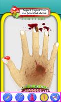 Hand Surgery اسکرین شاٹ 1