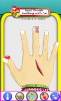 Hand Surgery اسکرین شاٹ 2