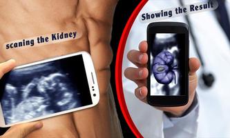 2 Schermata Ultrasound Scanner 3D Prank