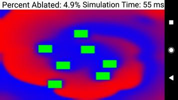 Biophysical Cardiac Ablation Simulator 海報
