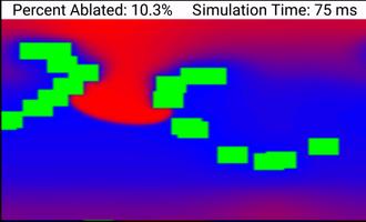 Biophysical Cardiac Ablation Simulator screenshot 2
