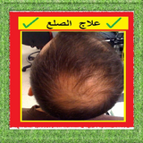 علاج الصلع بالأعشاب الطبيعية icono