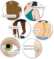 Genetic Disorders-poster