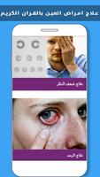 علاج أمراض العيون بالأعشاب فقط स्क्रीनशॉट 1