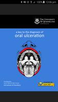 Diagnosis of Oral Ulceration poster