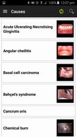 Diagnosis of Oral Ulceration screenshot 3