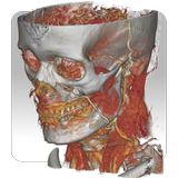 DroidRender - 3D DICOM viewer