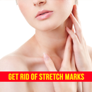 How to Get Rid of Stretch Mark APK