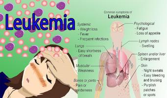 Leukemia الملصق