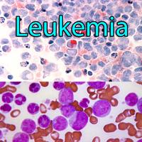 Leukemia تصوير الشاشة 1