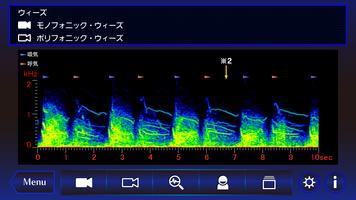 肺の聴診トレーニング－見える肺音 capture d'écran 1