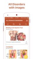 Stomach Diseases & Treatment capture d'écran 1