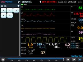 VitalViewer capture d'écran 3