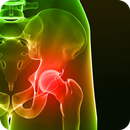 Cure Tight Hips Forever APK