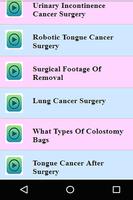 Cancer Surgery Videos capture d'écran 1