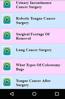 Cancer Surgery Videos スクリーンショット 3