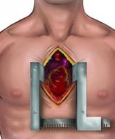 لعبة جراحة القلب المفتوح APK للاندرويد تنزيل
