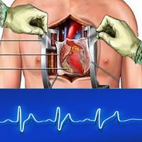 لعبة جراحة القلب المفتوح Affiche