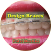 Design of Braces