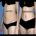 NO ELIMINA LA GRASA ABDOMINAL?