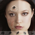 Pimple Acne Photo Editor icon