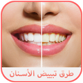 خلطات وطرق تبييض الأسنان بسرعة