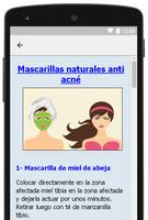 Remedios Caseros para el Acne Ekran Görüntüsü 3