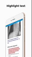 CXR FlashCards - Reference app for Chest X-rays capture d'écran 2