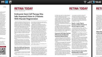 Retina Today screenshot 1