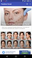 Parálisis Facial capture d'écran 1