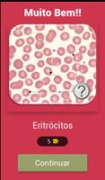 Questionário de Hematologia capture d'écran 1