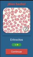 Quiz de Hematología capture d'écran 1