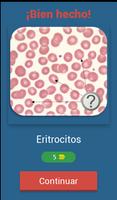 Quiz de Hematología تصوير الشاشة 1
