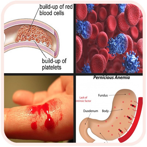 All Blood Disease & Treatment