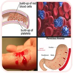 All Blood Diseases