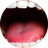 ¿A qué te huele el aliento?