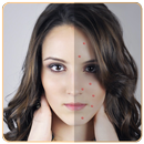 Acne remover-Pimple remover APK
